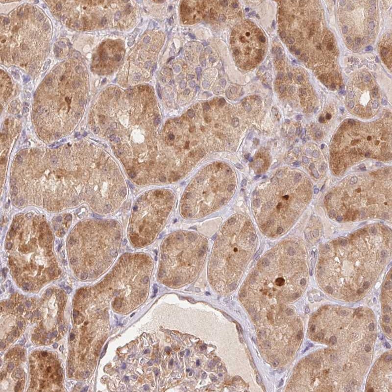 Anti-NUDT16 Antibody
