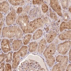 Anti-NUDT16 Antibody