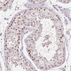 Anti-BATF2 Antibody