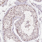 Anti-BATF2 Antibody