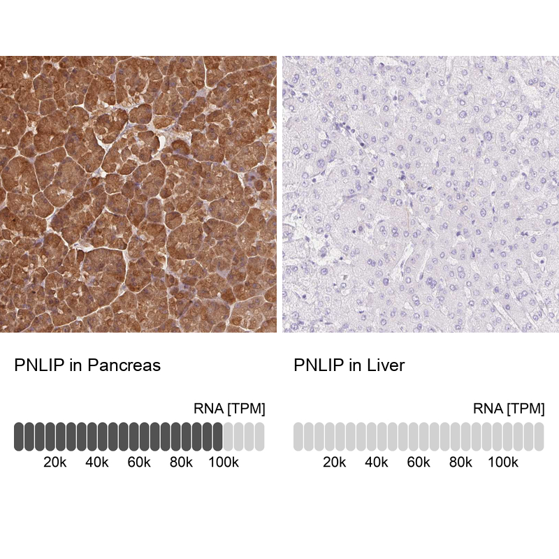 Anti-PNLIP Antibody