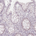 Anti-BATF2 Antibody