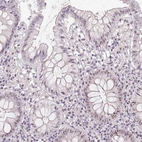 Immunohistochemical staining of human colon shows strong positivity in nucleoli in glandular cells.