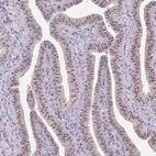 Immunohistochemical staining of human Fallopian tube shows strong positivity in nucleoli in glandular cells.