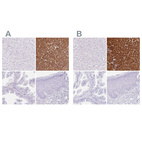 Immunohistochemical staining of human liver, pancreas, prostate and skin using Anti-PNLIP antibody HPA062494 (A) shows similar protein distribution across tissues to independent antibody HPA062430 (B).
