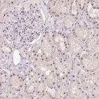 Immunohistochemical staining of human kidney shows strong positivity in nucleoli in cells in tubules.