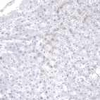 Immunohistochemical staining of human liver shows no positivity in hepatocytes as expected.