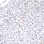 Anti-MSLN Antibody