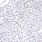 Immunohistochemical staining of human liver shows no positivity in hepatocytes as expected.