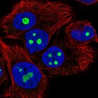 Immunofluorescent staining of human cell line SK-MEL-30 shows localization to nucleoli.