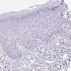 Immunohistochemical staining of human skin shows no positivity in squamous epithelial cells as expected.