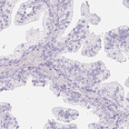 Immunohistochemical staining of human prostate shows no positivity in glandular cells as expected.