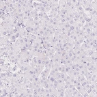 Immunohistochemical staining of human liver shows no positivity in hepatocytes as expected.