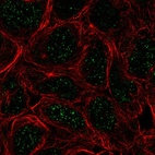 Anti-TBX6 Antibody