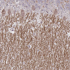 Immunohistochemical staining of human cerebellum shows moderate positivity in neuronal processes in neuropil.