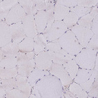 Immunohistochemical staining of human skeletal muscle shows no positivity in myocytes as expected.