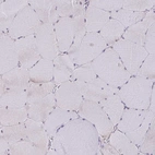 Immunohistochemical staining of human skeletal muscle shows no positivity in myocytes as expected.
