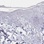 Immunohistochemical staining of human skin shows no positivity in squamous epithelial cells as expected.