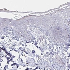 Immunohistochemical staining of human skin shows no positivity in squamous epithelial cells as expected.