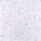 Anti-MSLN Antibody