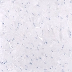 Immunohistochemical staining of human skeletal muscle shows no positivity in myocytes as expected.