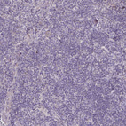 Immunohistochemical staining of human tonsil shows no positivity in non-germinal center cells as expected.