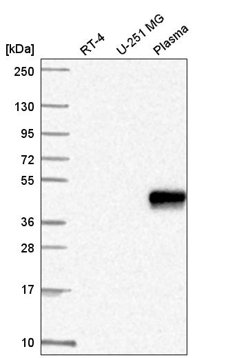 Anti-ZNF672 Antibody