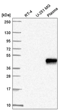 Anti-ZNF672 Antibody