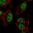 Immunofluorescent staining of human cell line PC-3 shows localization to nucleoplasm.