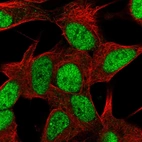 Immunofluorescent staining of human cell line SH-SY5Y shows localization to nucleoplasm.