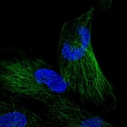 Anti-NKIRAS1 Antibody