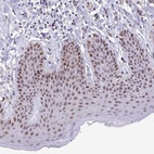 Anti-ZNF691 Antibody