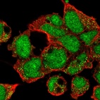 Immunofluorescent staining of human cell line HEK 293 shows localization to nucleus & vesicles.