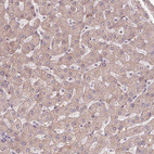 Immunohistochemical staining of human liver shows moderate cytoplasmic positivity in hepatocytes.