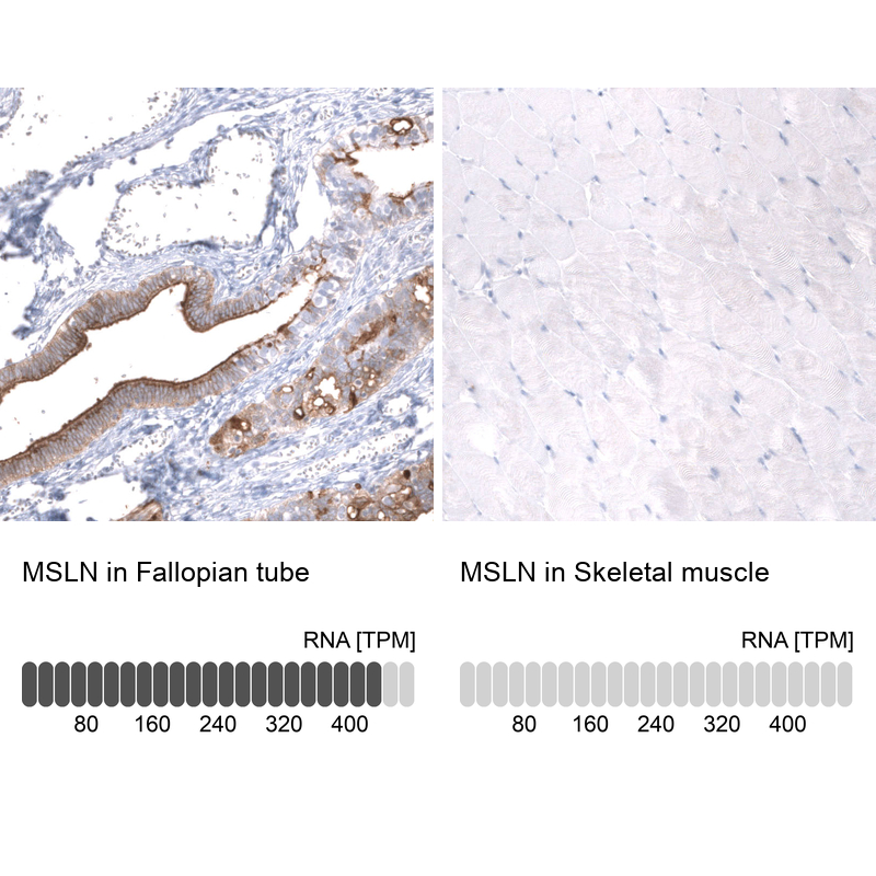 Anti-MSLN Antibody