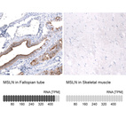 Anti-MSLN Antibody