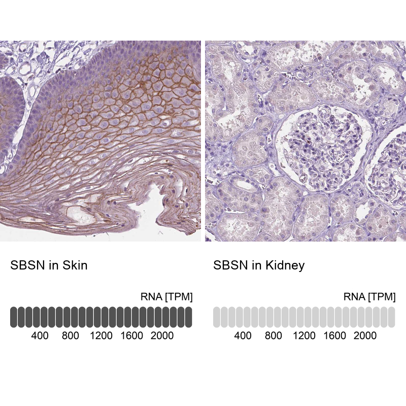 Anti-SBSN Antibody