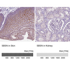 Anti-SBSN Antibody