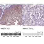 Anti-SBSN Antibody