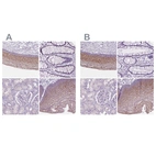 Immunohistochemical staining of human cervix, uterine, gastrointestinal, kidney and skin using Anti-SBSN antibody HPA062568 (A) shows similar protein distribution across tissues to independent antibody HPA067734 (B).