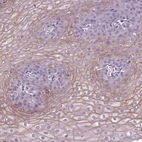 Immunohistochemical staining of human esophagus shows moderate membranous positivity in squamous epithelial cells.