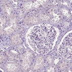 Immunohistochemical staining of human kidney shows no positivity in cells in glomeruli as expected.