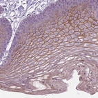 Immunohistochemical staining of human skin shows moderate membranous positivity in squamous epithelial cells.
