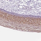 Immunohistochemical staining of human cervix, uterine shows moderate membranous positivity in squamous epithelial cells.