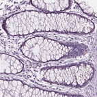 Immunohistochemical staining of human rectum shows no positivity in glandular cells as expected.
