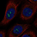Anti-MPPED2 Antibody
