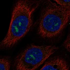 Anti-MPPED2 Antibody