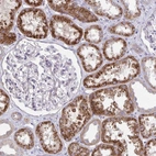 Anti-KATNBL1 Antibody
