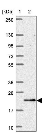 Lane 1: Marker [kDa] 250, 130, 95, 72, 55, 36, 28, 17, 10_br/_Lane 2: Human cell line RT-4