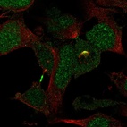 Immunofluorescent staining of human cell line AF22 shows localization to nucleus, midbody & mitotic spindle.
